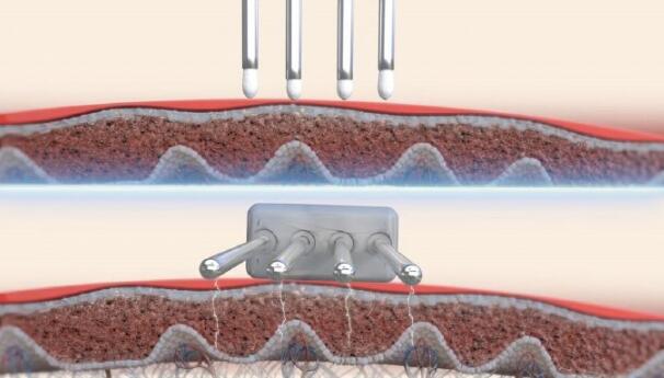 Ƥ����˥������ӭ��ͻ�� ��͸Ƥ��ԭ�⡱������Ϊ��˥������